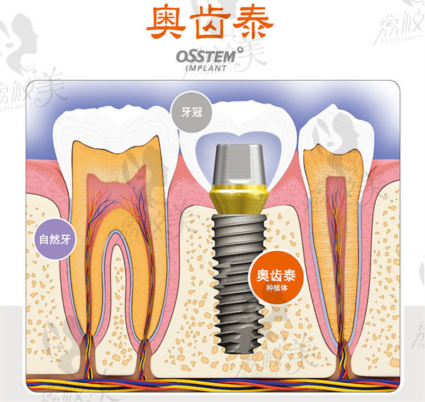 奧齒泰