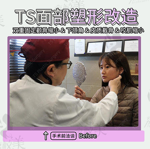 面诊