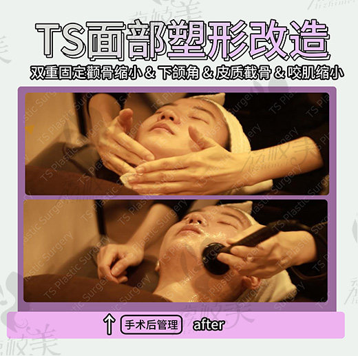 术后护理