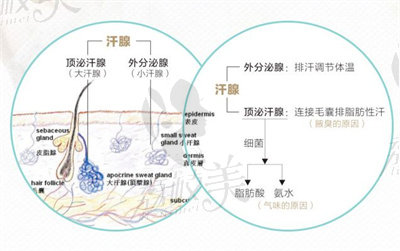 德国VISA显微消融术的手术过程.jpg