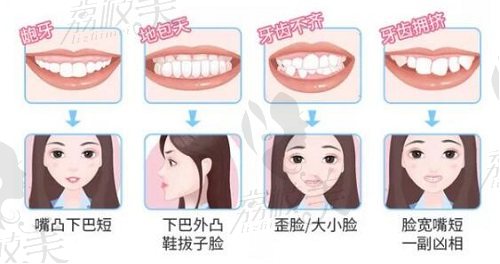 牙齿矫正适用人群