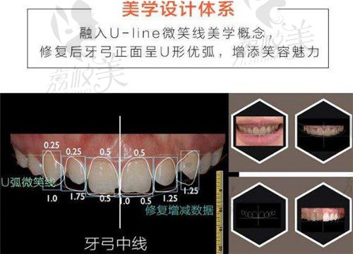 襄阳大众口腔牙齿矫正审美