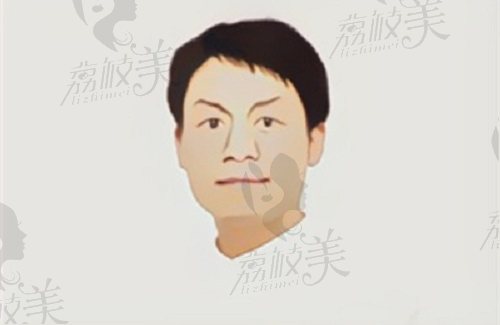 上海谷提斯口腔许项杰医生