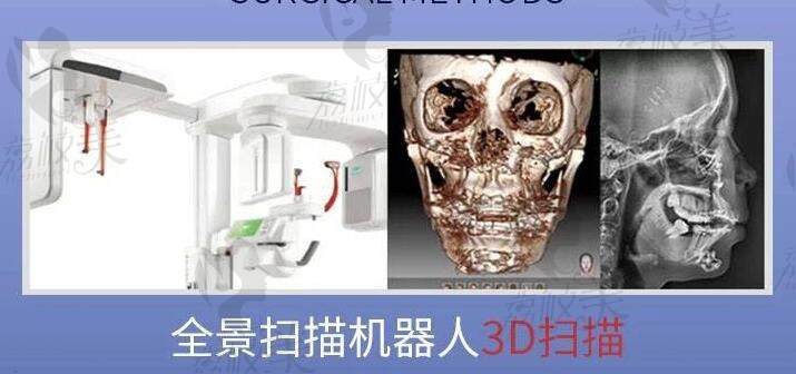 南醫(yī)大友誼整形3D下頜角縮小技術(shù)特色