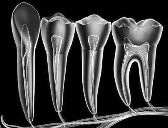 根管示意图