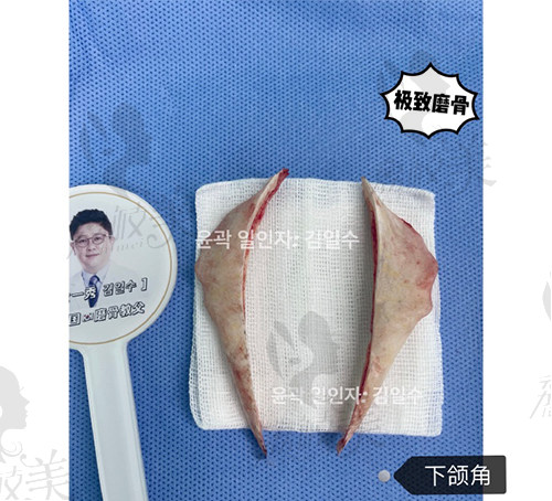 金一秀和张柱允谁磨骨技术好