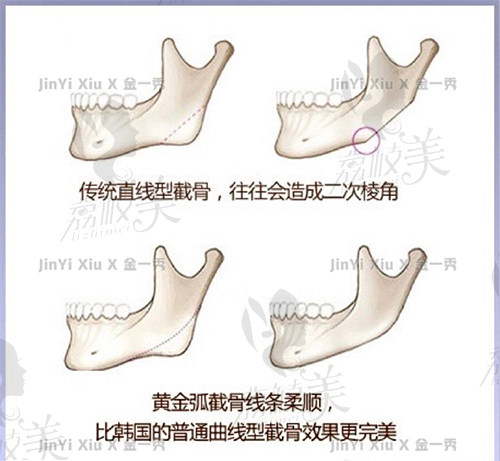金一秀和张柱允谁磨骨技术好