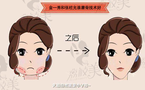 金一秀和张柱允谁磨骨技术好