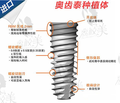 韩国奥齿泰种植牙特点优势