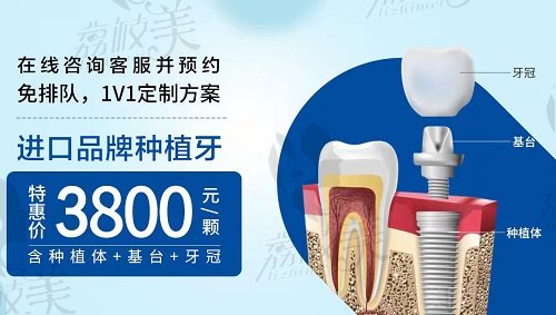 上海康态口腔门诊部种植牙项目