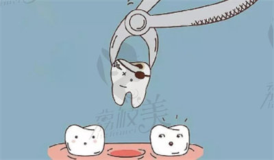 种植牙手术.jpg