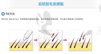 徐州曙光整形植发