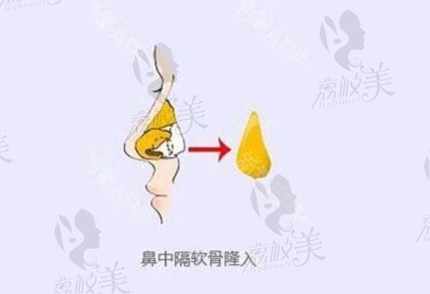 北京百達(dá)麗醫(yī)療美容鼻整形