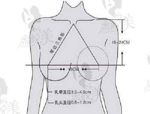 武汉艺星整形医院胸部整形