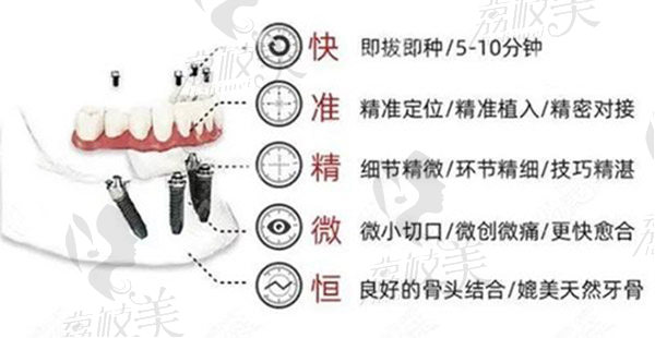 上海罗缘口腔门诊部核心技术