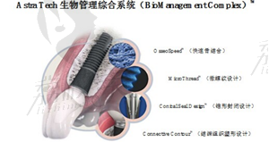 Astra种植牙优势