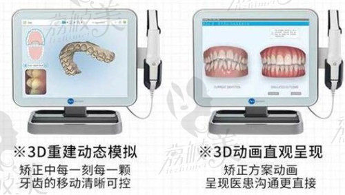 蕪湖江城口腔牙齒矯正