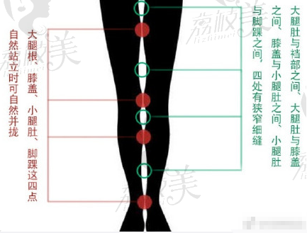 重慶腿型矯正的參考點