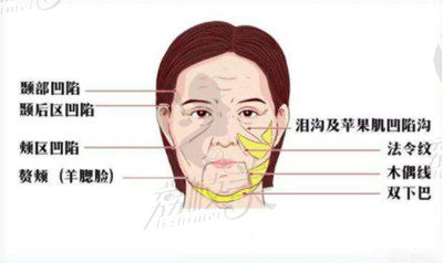 小切口除皱.jpg