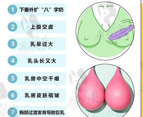 深圳南雅整形花苞提升术可解决的胸部问题