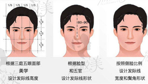 熙朵發(fā)際線種植審美