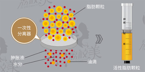 蘇州美貝爾聶志宏面部脂肪填充好嗎