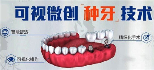 华美种植牙过程优势