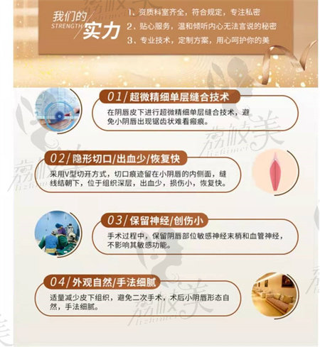 3d生物束带优势