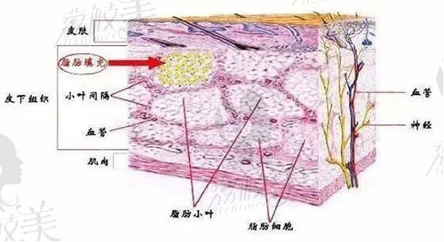 广州军美王世虎自体脂肪填充技术