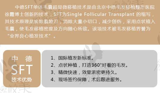 北京中德毛发移植技术怎么样？