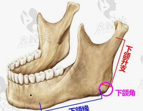 张笑天下颌角手术