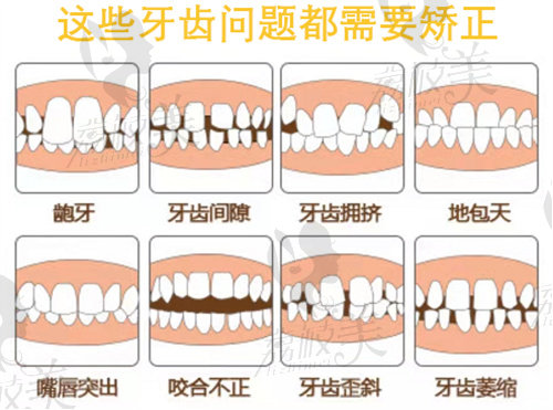 洛阳牙齿矫正比较好的口腔医院公布，含价格参考及正畸医生推荐