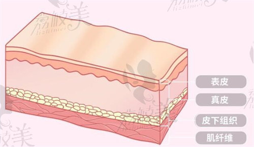 玻尿酸注射皮肤层