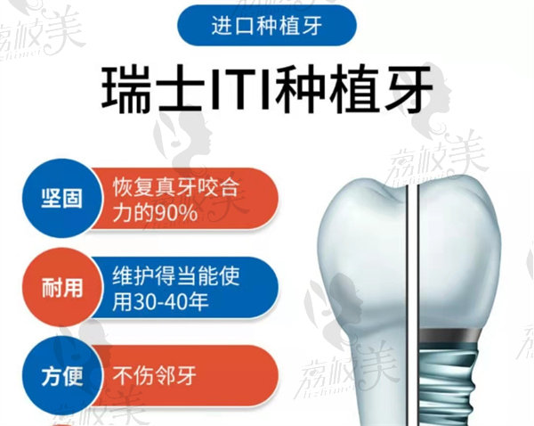 宁波美呀植联口腔种植牙
