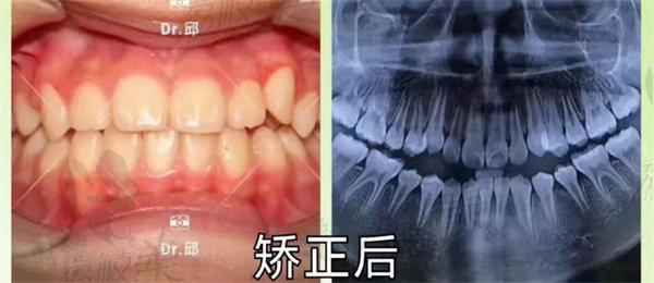 深圳青苗口腔實例