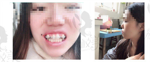 成都新桥口腔