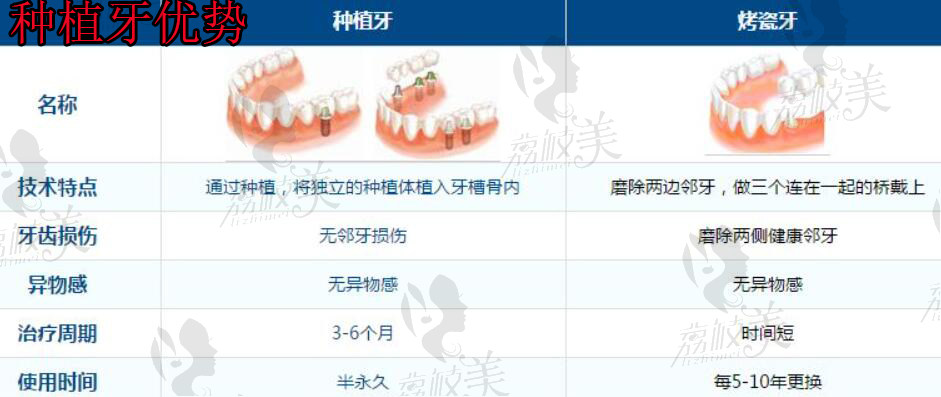 岳阳种植牙多少钱一颗