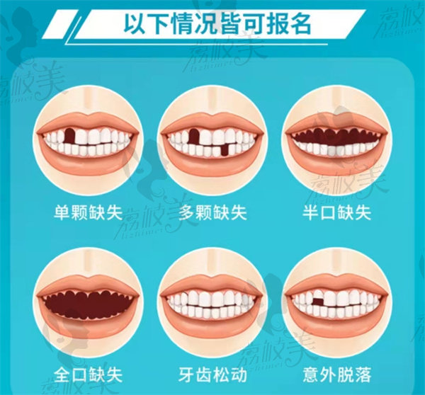 长沙美奥口腔种植牙