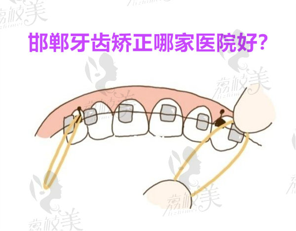 邯郸牙齿矫正哪家医院好？