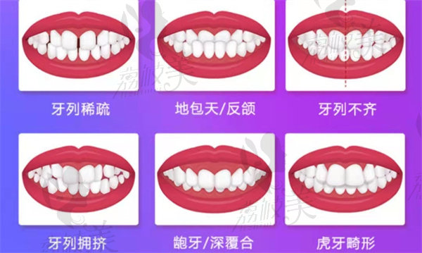 广州广大口腔牙齿畸形