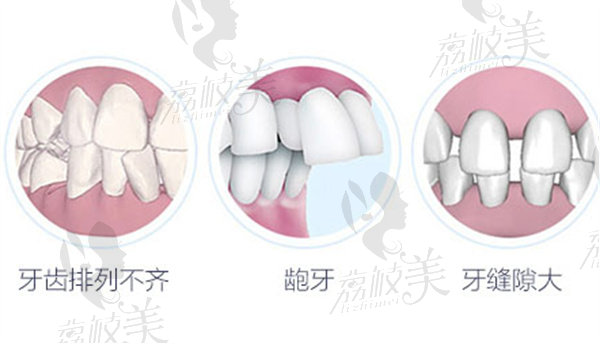 珠海同道口腔矫正