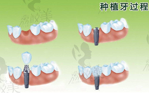 北京房山区口腔门诊价格