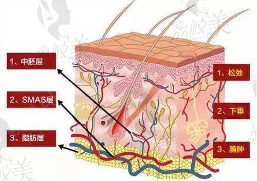 皮肤结构示意图