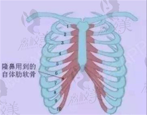 肋骨所取部位