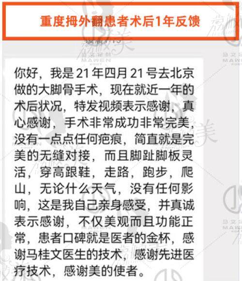 患者在马文足科做完大脚骨矫正手术后的评价