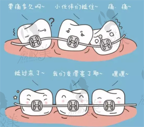 郑州唯美医院牙齿矫正示意图