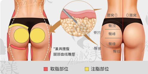 潤美玉之光脂肪豐臀部位