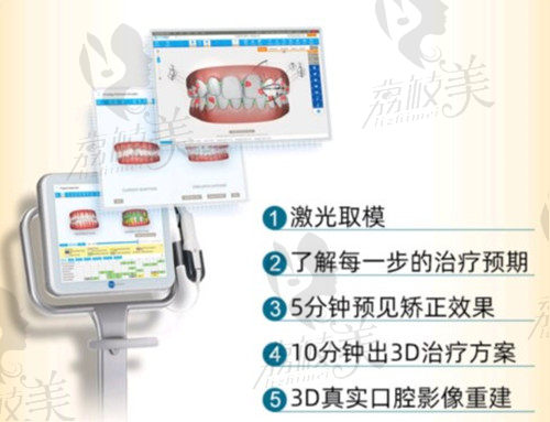 廣州家庭醫(yī)生口腔醫(yī)院3D口掃