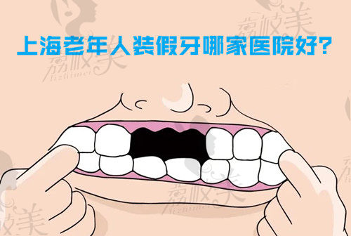汇总上海老年牙科医院名单,告诉您装假牙哪个医院好还便宜