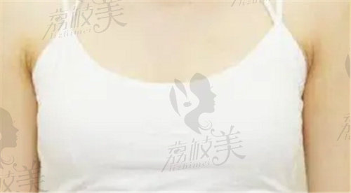 徐少駿醫(yī)生隆胸手術(shù)前